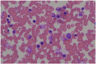 Blood cells micrograph